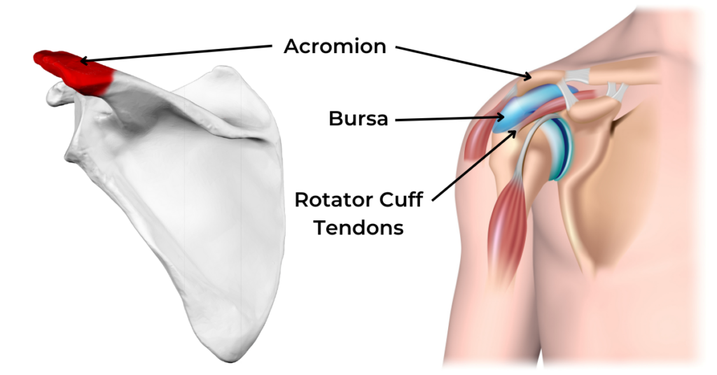 diagram showing the acromion, bursa, and rotator cuff tendons