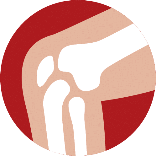 Knee Replacement Icon