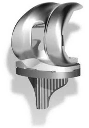 Rotator cuff tear replacement