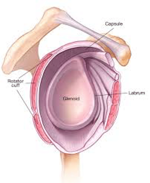 Labral tear 3D images