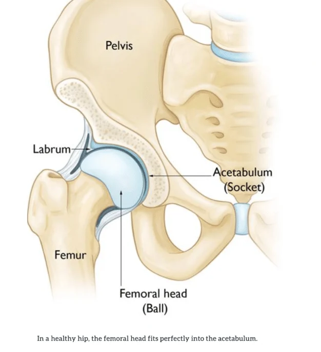 femoroacetabular impingement causes boise