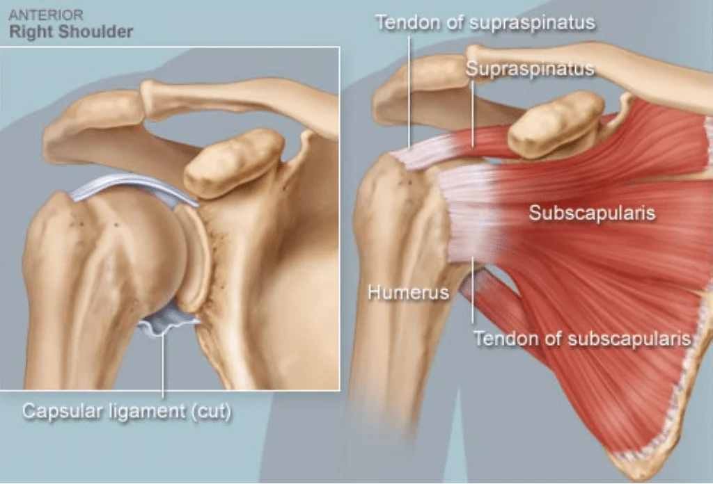 rotator cuff tear boise
