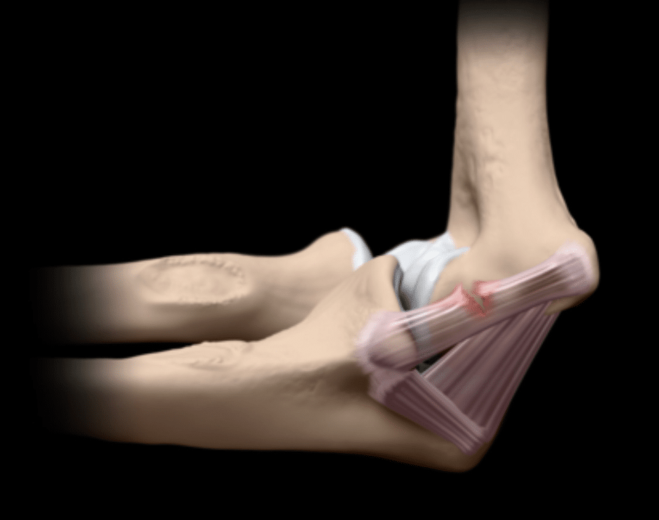 tommy john muscle injury boise